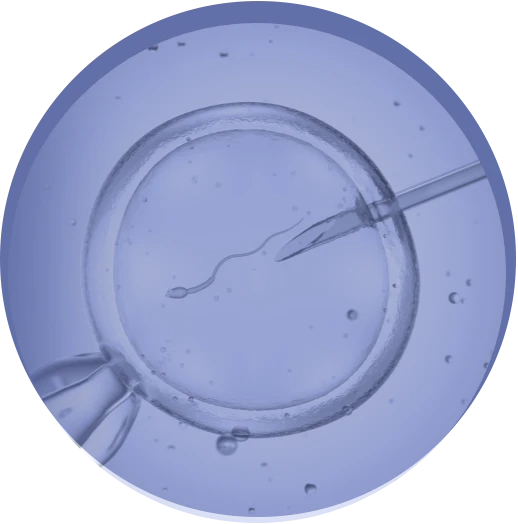 Illustrazione di un ovocita in fase di iniezione con uno spermatozoo, utilizzata per rappresentare l'area specialistica "IVF" di Eurofins Genoma, specializzata nella Procreazione Medicalmente Assistita (PMA) e nelle analisi genetiche reimpianto.