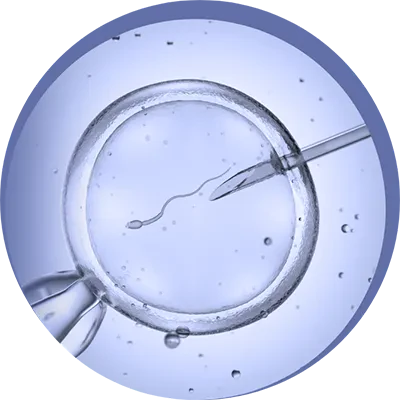 Immagine illustrativa del processo di fertilizzazione in vitro (IVF), rappresentativa dell'attività di Eurofins Genoma nei test genetici e nella Procreazione Medicalmente Assistita.