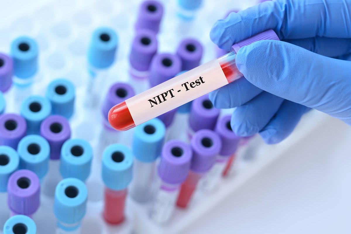 Test genetici a casa o test diagnostici in ospedale?